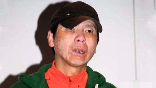 明星 白癜风,勇敢面对，绽放光芒